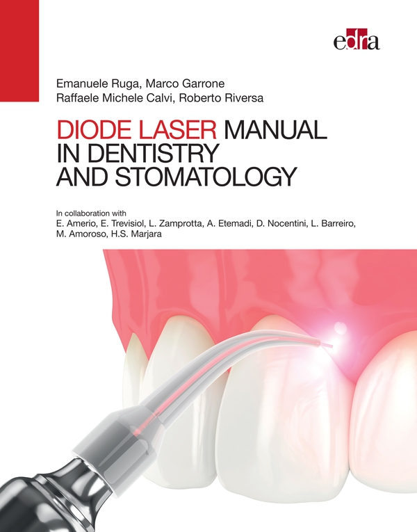 Manual of diode laser in dentistry and stomatology - Librerie.coop Manual of diode laser in dentistry and stomatology - Librerie.coop
