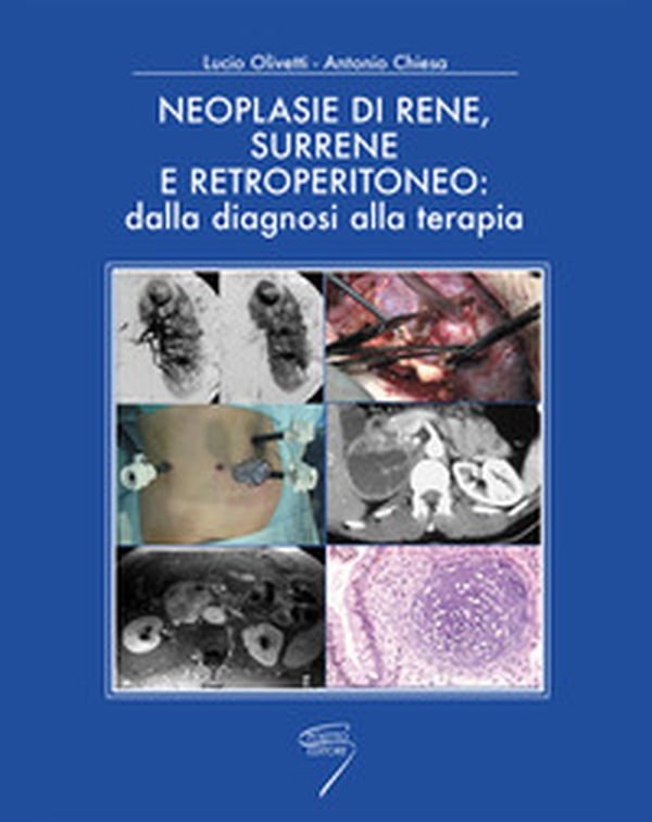 Neoplasie di rene, surrene e retroperitioneo: dalla diagnosi alla terapia - Librerie.coop Neoplasie di rene, surrene e retroperitioneo: dalla diagnosi alla terapia - Librerie.coop