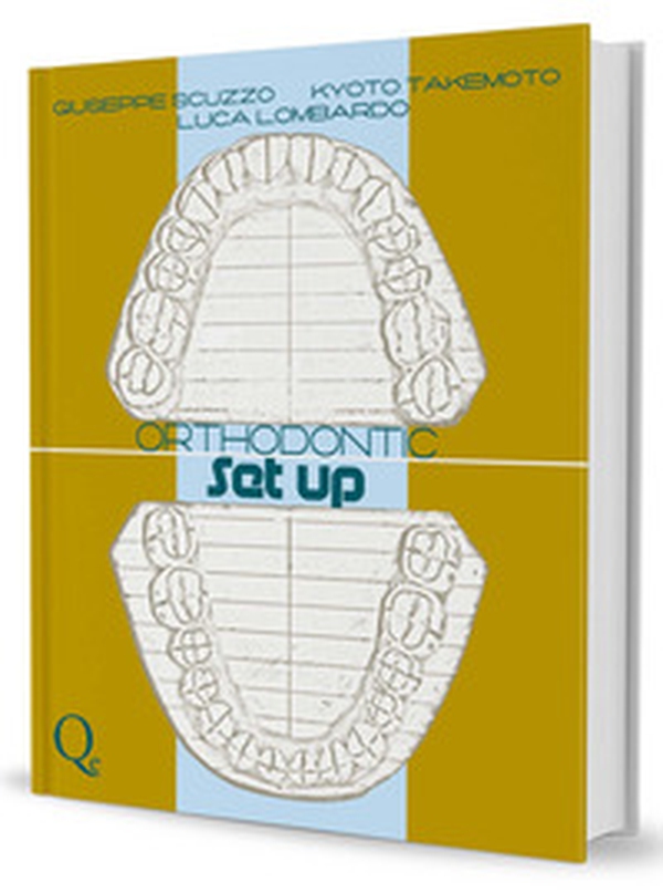 Orthodontic setup - Librerie.coop Orthodontic setup - Librerie.coop